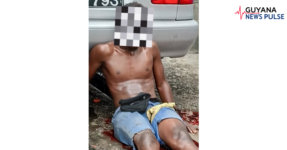 Knife-armed 13-Y-O shot during attempted robbery outside Brickdam Cathedral